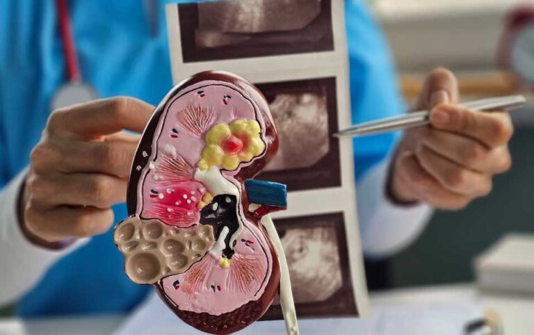 Transplante Renal